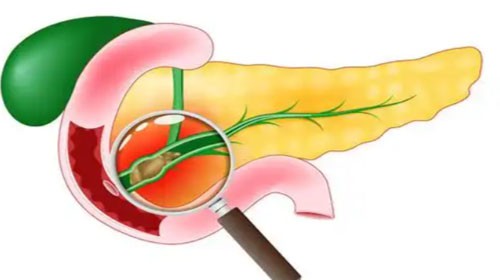 Octreotide For sale | Shaanxi BLOOM Tech Co., Ltd Octreotide For sale | Shaanxi BLOOM Tech Co., Ltd